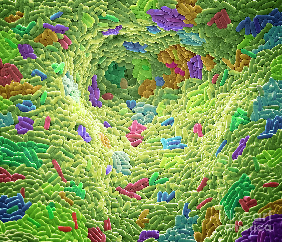 Skin Bacteria Photograph By Steve Gschmeissner Science Photo Library