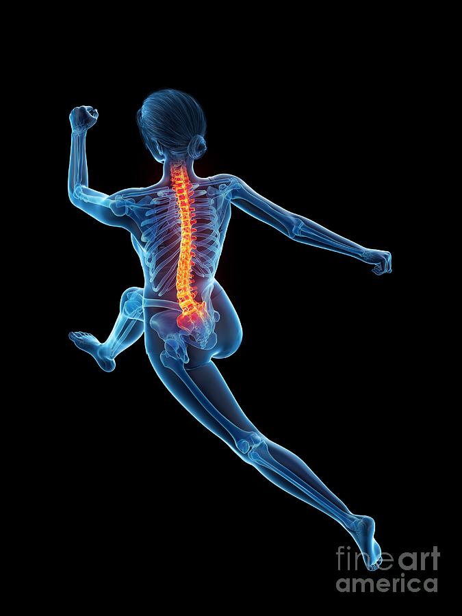 Woman With A Painful Back While Running #11 Photograph by Sebastian Kaulitzki/science Photo Library