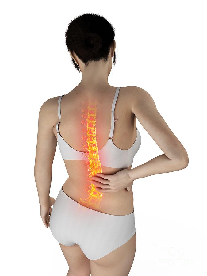 Woman With A Painful Back #119 Photograph by Sebastian Kaulitzki/science Photo Library