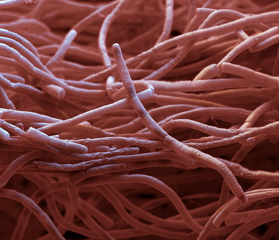 Anthrax Bacteria Sem #12 Photograph by Meckes/ottawa