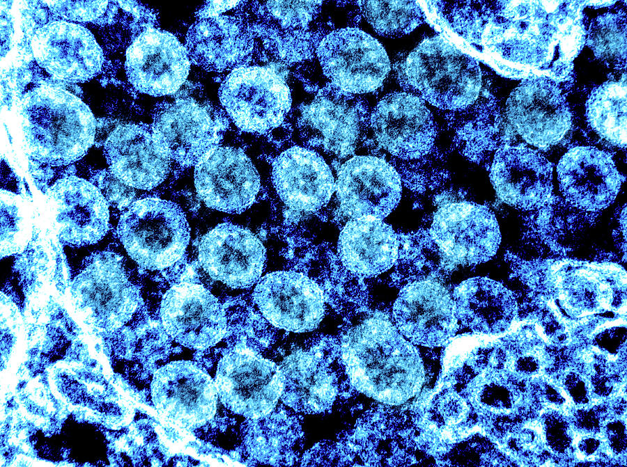 Sars-cov-2, Covid-19 Virus, Tem #12 Photograph by Science Source
