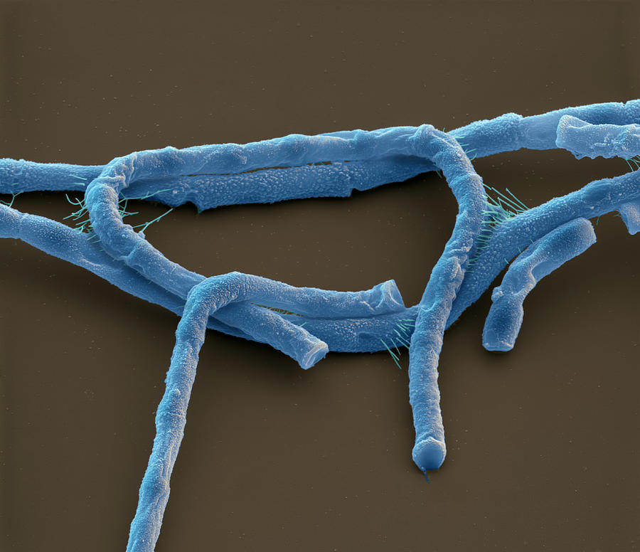 Anthrax Bacteria Sem Photograph By Meckesottawa Fine Art America 9064