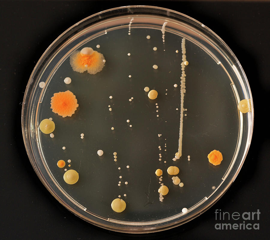 Cultures Growing On Petri Dish #13 Photograph by Wladimir Bulgar ...