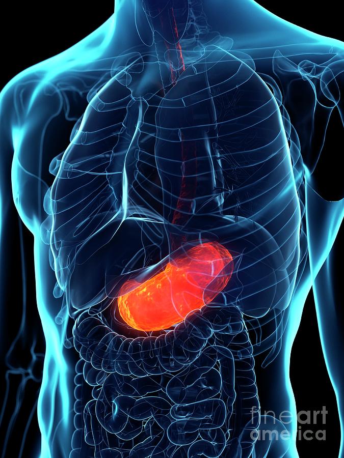 Diseased Stomach Photograph by Sebastian Kaulitzki/science Photo ...