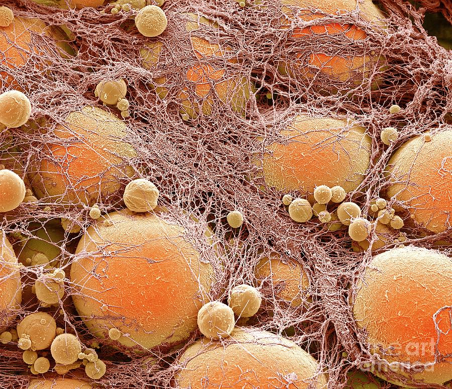 Fat Cells #13 Photograph by Steve Gschmeissner/science Photo Library