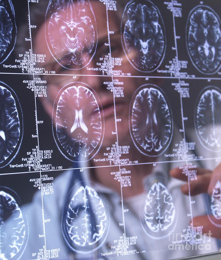 Neurology Diagnosis #13 Photograph by Tek Image/science Photo Library