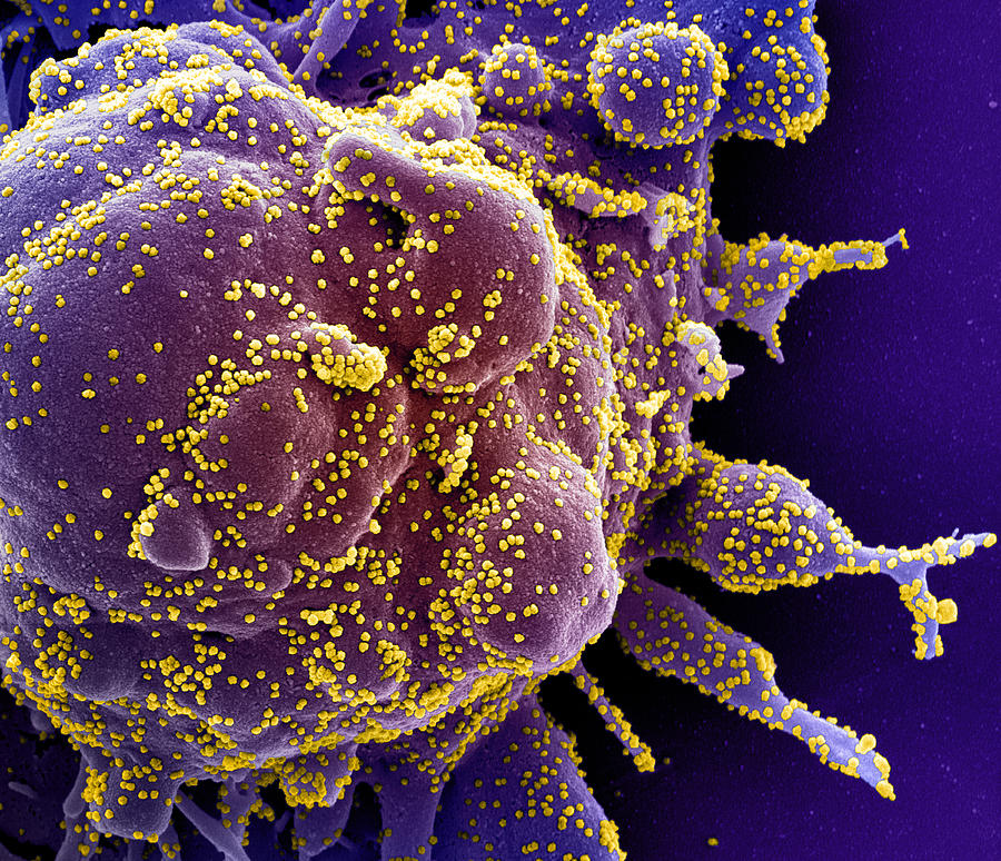 Sars-cov-2, Covid-19 Virus, Sem #13 Photograph by Science Source