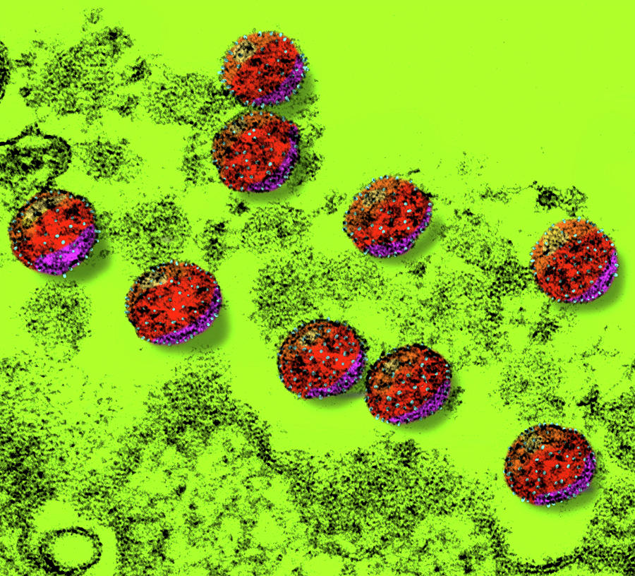 Sars-cov-2, Covid-19 Virus, Tem #13 Photograph by Science Source