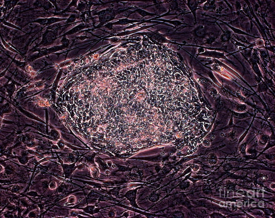 Stem Cells #13 Photograph by Professor Miodrag Stojkovic/science Photo Library