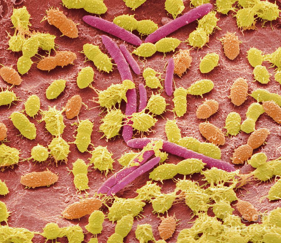 Faecal Bacteria Photograph By Steve Gschmeissner Science Photo Library