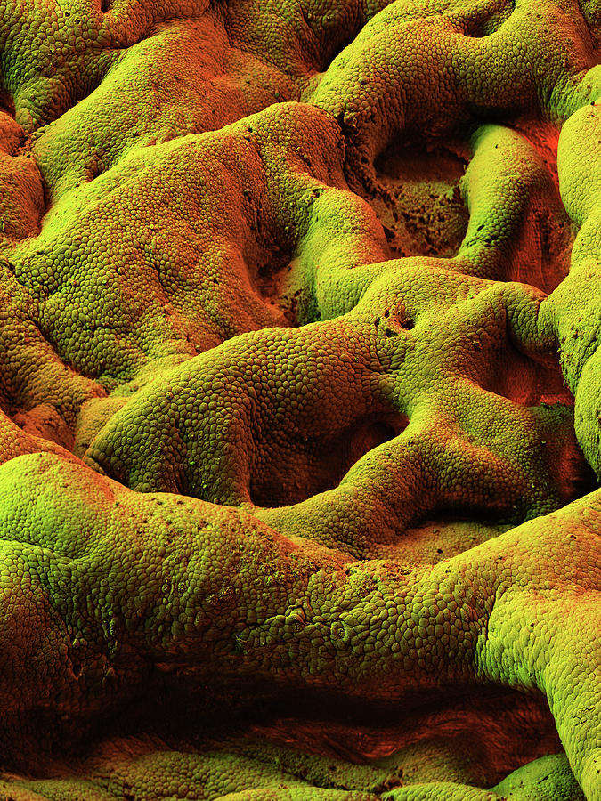 Gallbladder, Sem #14 Photograph by Eye Of Science