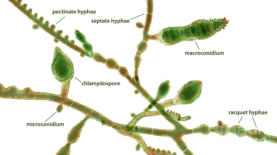 Microsporum Audouinii Fungus #14 by Science Photo Library