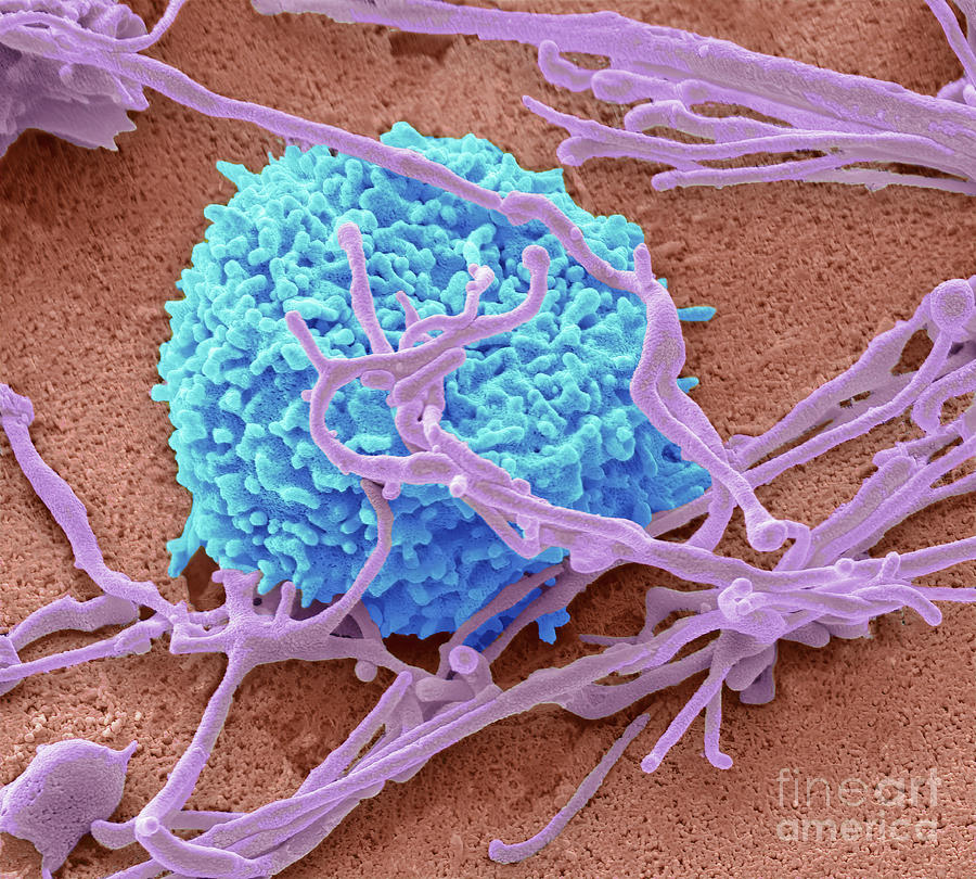 Natural Killer Cell Photograph by Steve Gschmeissner/science Photo ...