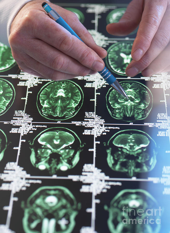 Neurology Diagnosis #14 Photograph by Tek Image/science Photo Library