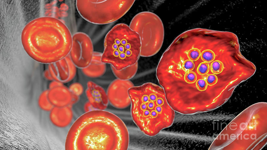 Plasmodium Ovale Inside Red Blood Cell #14 Photograph by Kateryna Kon/science Photo Library