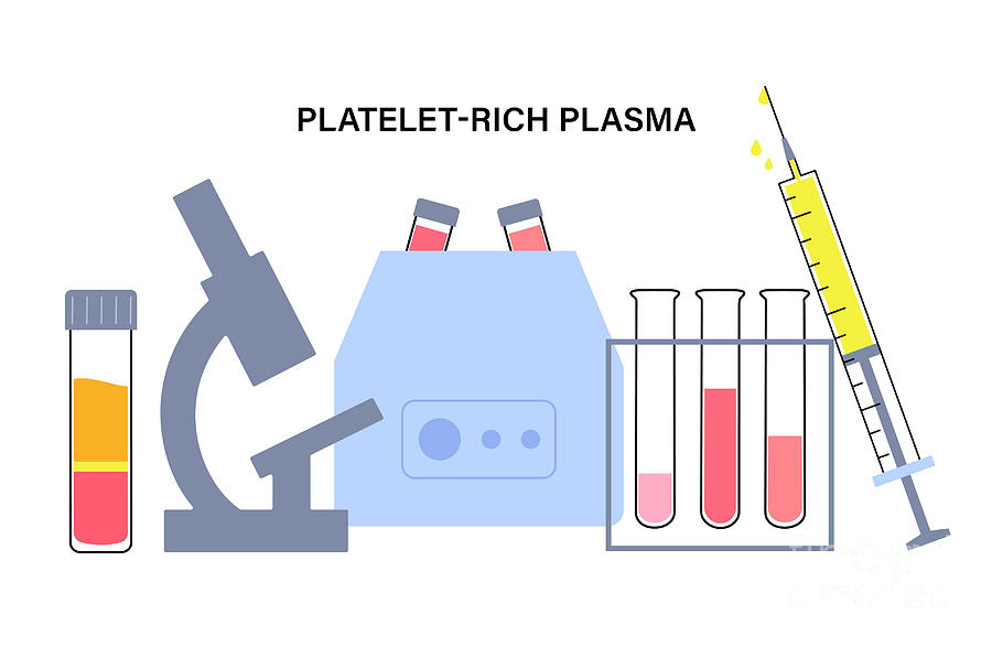 Platelet Rich Plasma Therapy Photograph By Pikovit / Science Photo ...