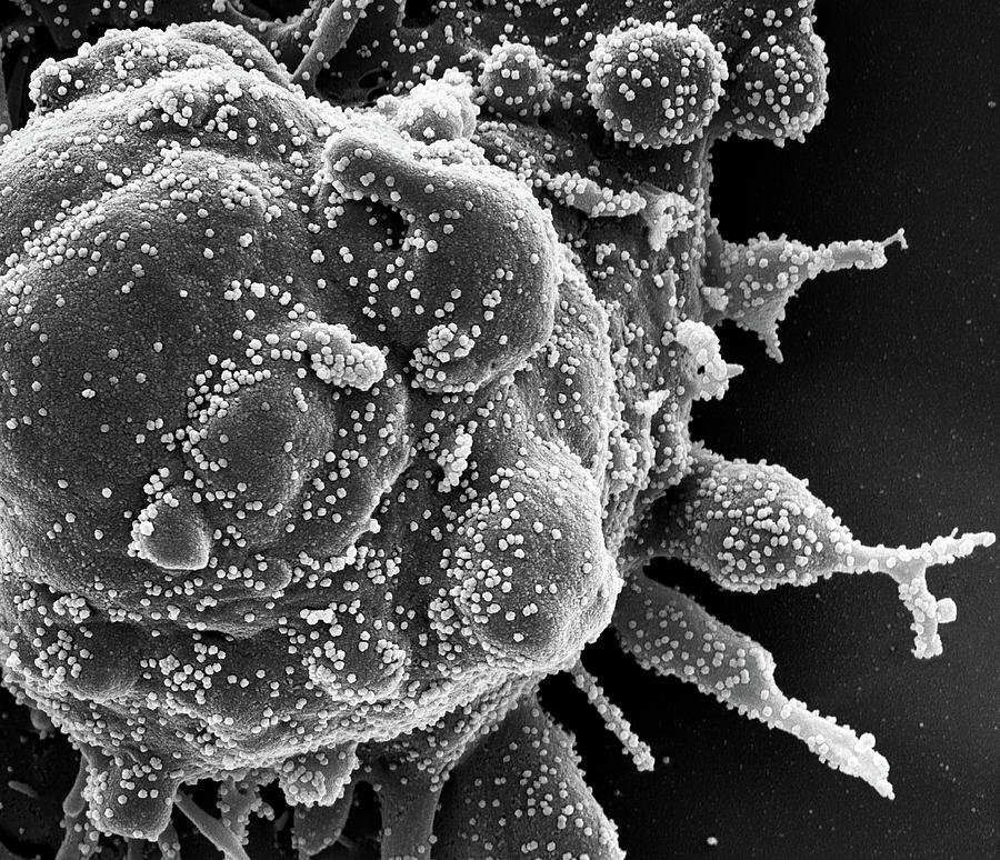 Sars-cov-2, Covid-19 Virus, Sem #14 Photograph by Science Source
