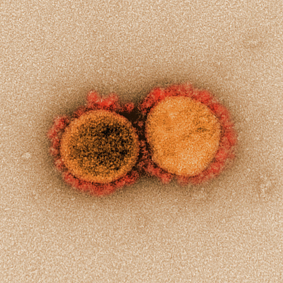 Sars-cov-2, Covid-19 Virus, Tem #14 Photograph by Science Source