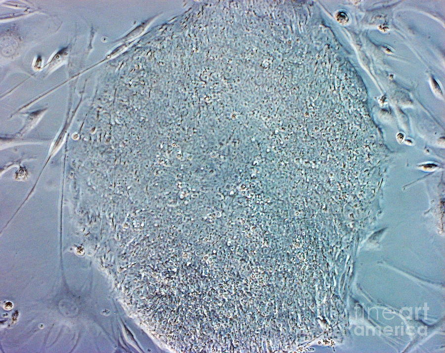 Stem Cells #14 Photograph by Professor Miodrag Stojkovic/science Photo Library