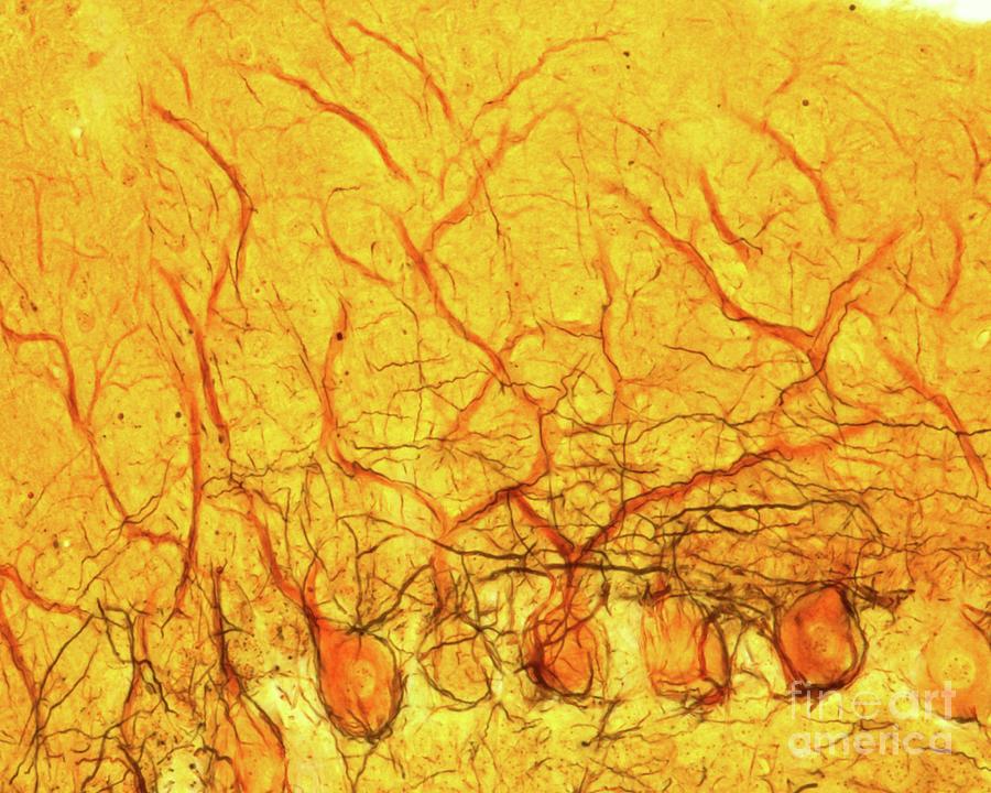 Cerebellar Cortex #15 Photograph by Jose Calvo / Science Photo Library