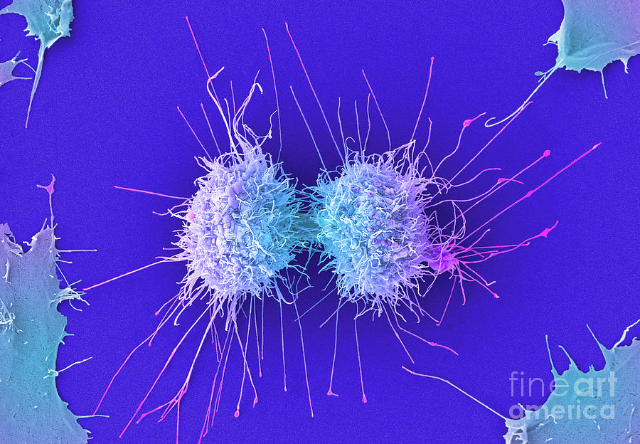 cervical cancer cells