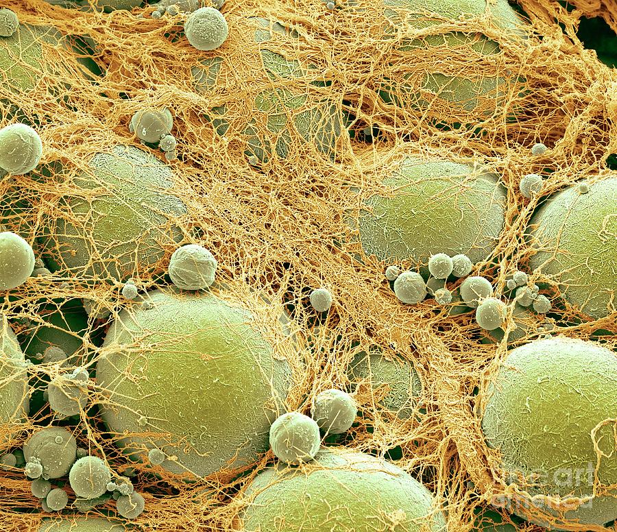 Fat Cells #15 Photograph by Steve Gschmeissner/science Photo Library