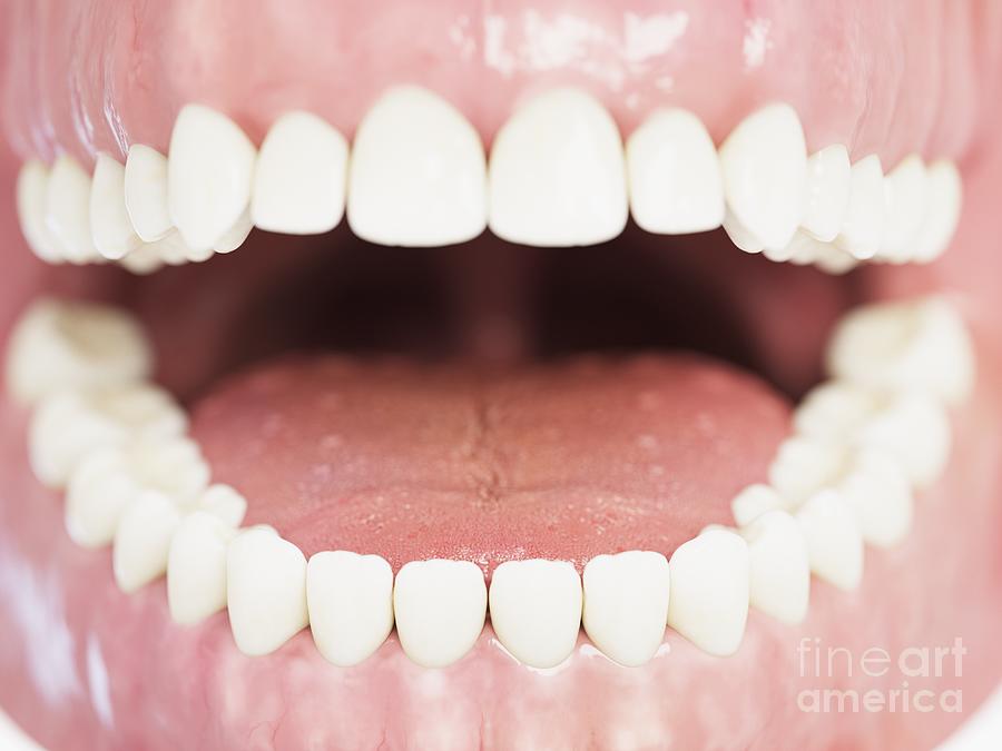 Human Teeth #15 Photograph by Sebastian Kaulitzki/science Photo Library