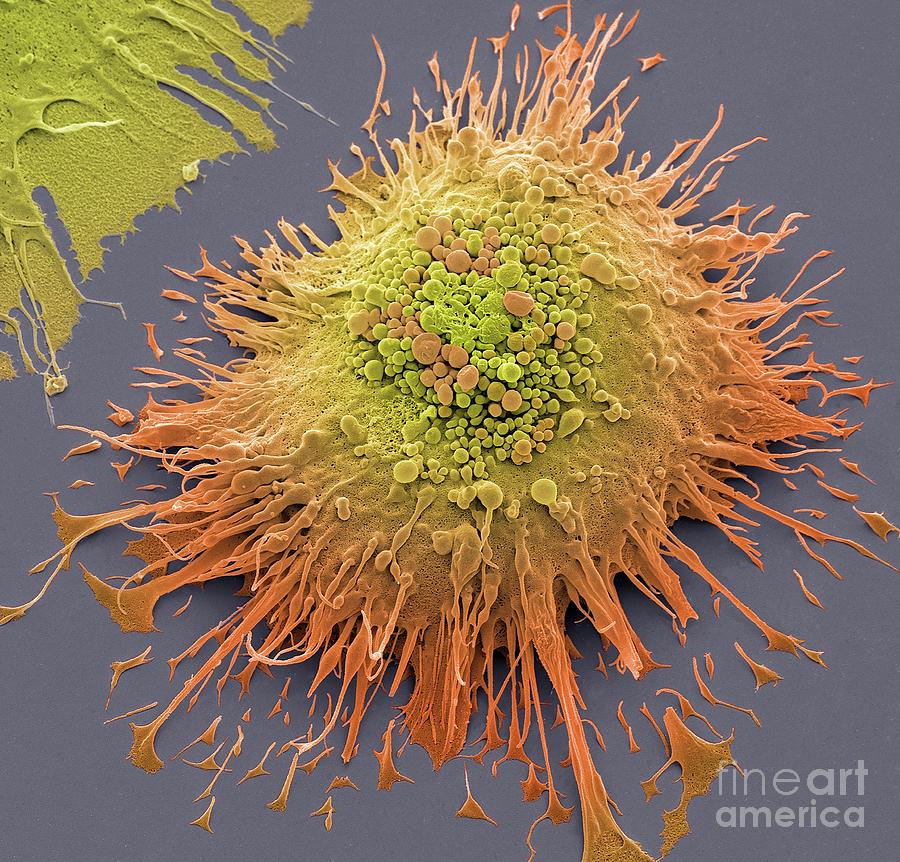 Macrophage Photograph By Steve Gschmeissner Science Photo Library Pixels