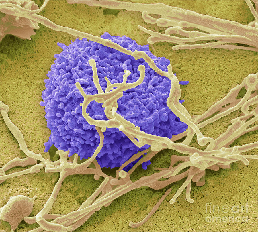 Natural Killer Cell Photograph by Steve Gschmeissner/science Photo ...