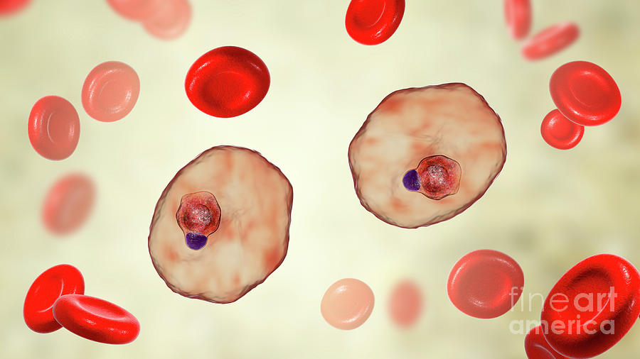 Plasmodium Ovale Inside Red Blood Cell #15 Photograph by Kateryna Kon/science Photo Library