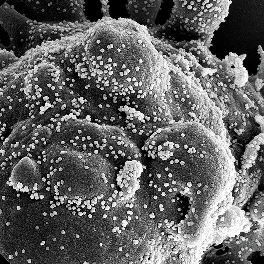 Sars-cov-2, Covid-19 Virus, Sem #15 Photograph by Science Source