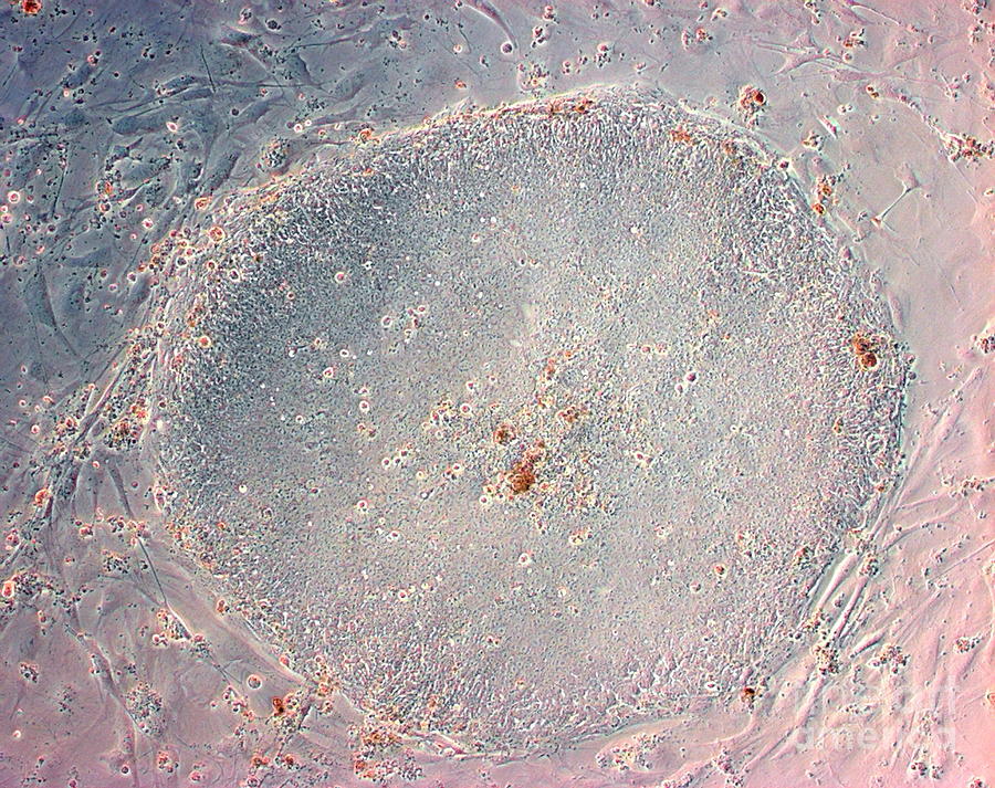 Stem Cells #15 Photograph by Professor Miodrag Stojkovic/science Photo Library