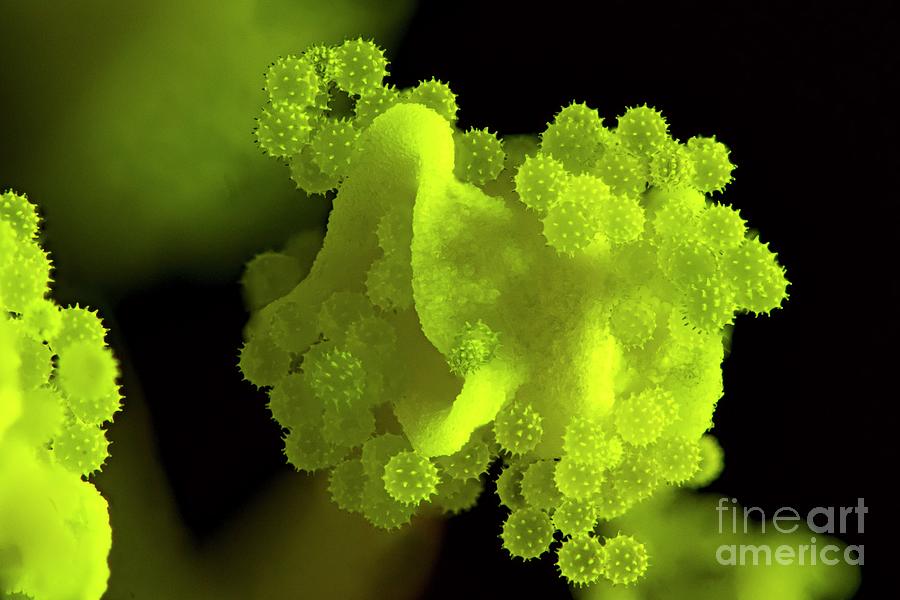 Hibiscus Flower Reproductive Organs In Uv Light Photograph by Frank Fox ...