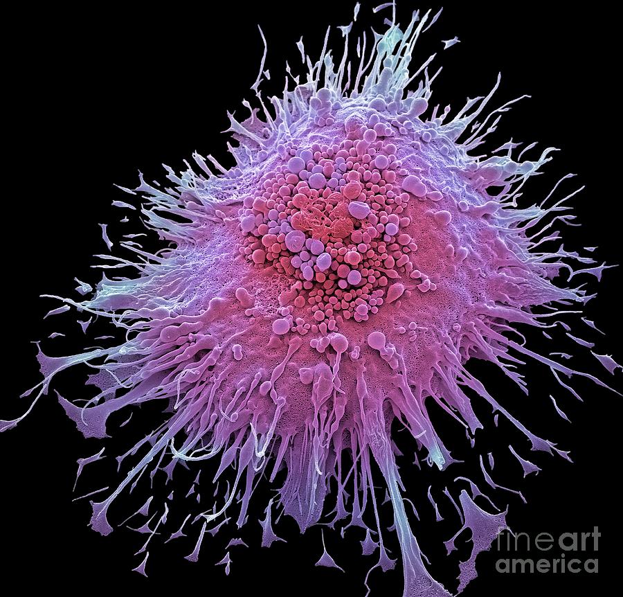 Macrophage Photograph by Steve Gschmeissner/science Photo Library | Pixels