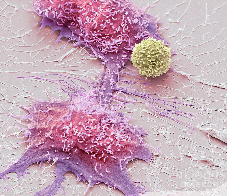 Natural Killer Cell And Cancer Cell Photograph By Steve Gschmeissnerscience Photo Library Pixels 0756