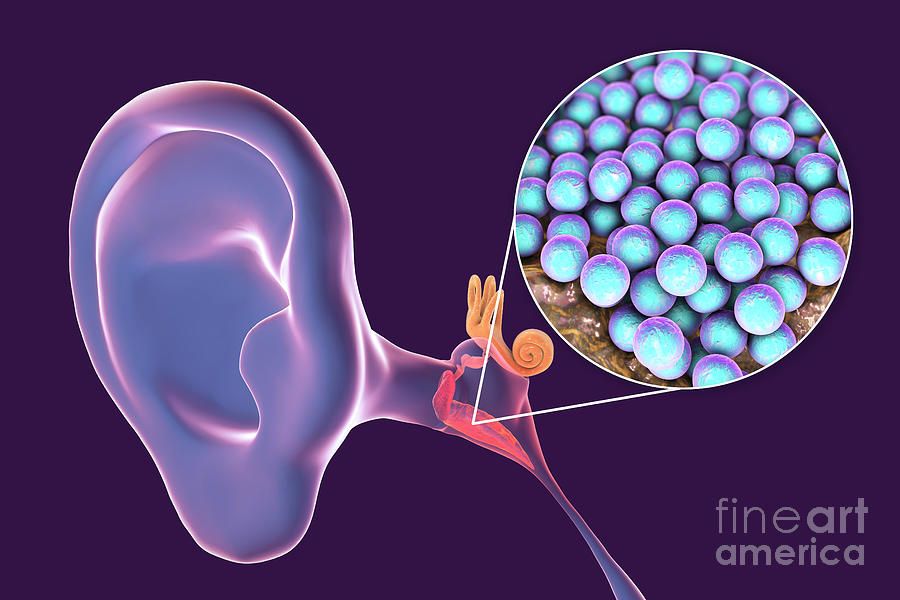 Otitis Media Ear Infection Photograph By Kateryna Kon/science Photo ...