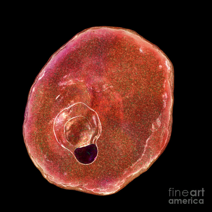 Plasmodium Ovale Inside Red Blood Cell #16 Photograph by Kateryna Kon/science Photo Library