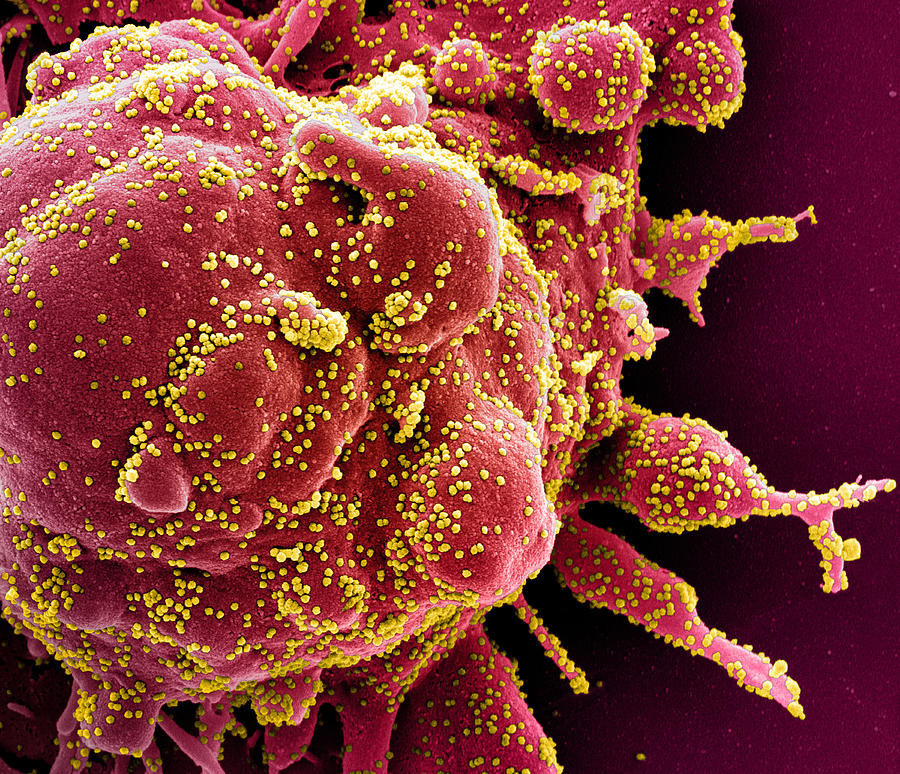 Sars-cov-2, Covid-19 Virus, Sem #16 Photograph by Science Source