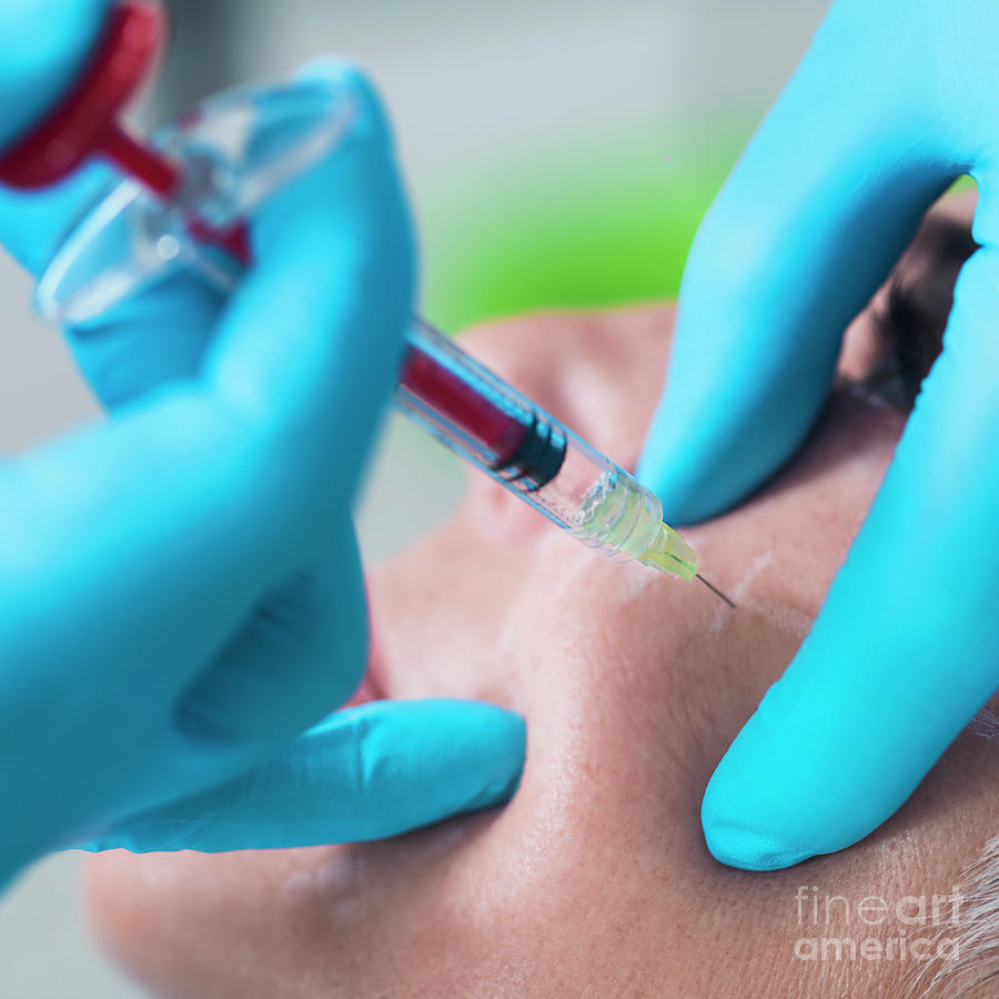 Woman Having Hyaluronic Acid Injections Photograph by Microgen Images