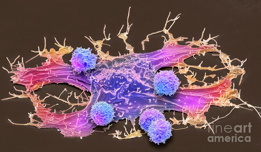 Car T-cell Therapy #17 Photograph by Steve Gschmeissner/science Photo Library