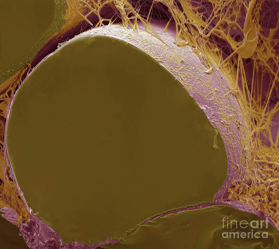 Fat Cells #17 Photograph by Steve Gschmeissner/science Photo Library