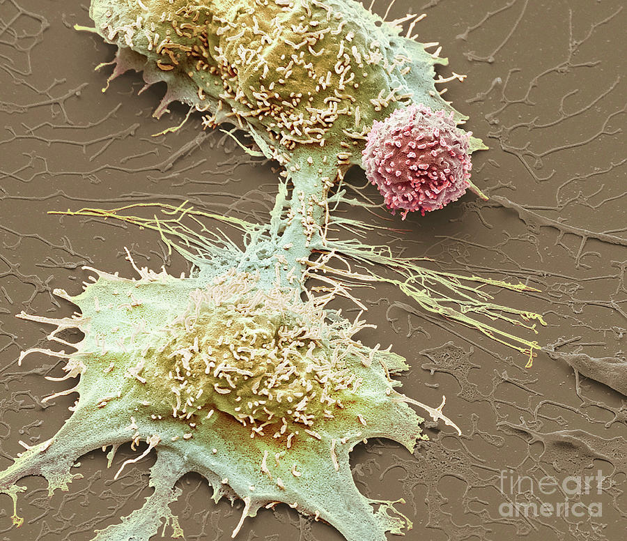 Natural Killer Cell And Cancer Cell Photograph by Steve Gschmeissner ...