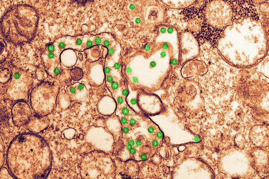 Sars-cov-2, Covid-19 Virus, Tem #17 Photograph by Science Source