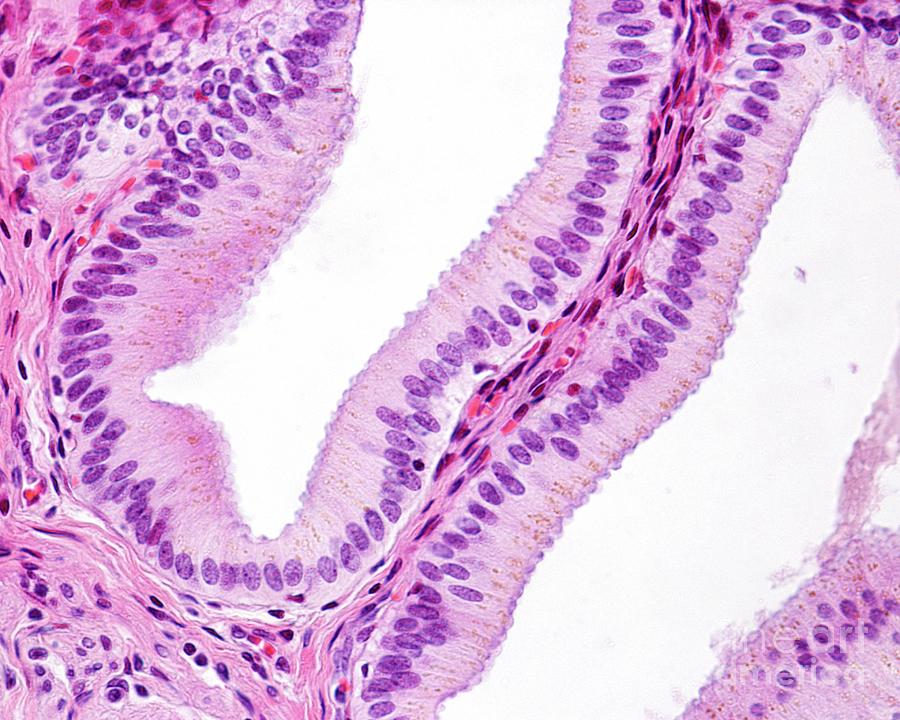 Simple Columnar Epithelium Photograph By Jose Calvo Science Photo Library Pixels 9068