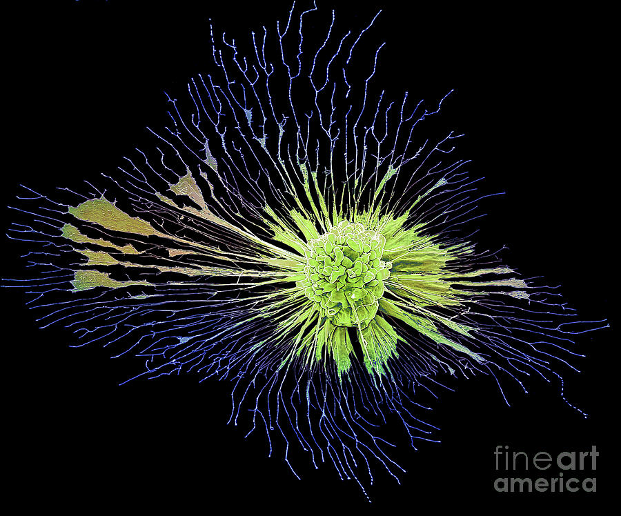 Chemotherapy #18 Photograph by Steve Gschmeissner/science Photo Library Chemotherapy #18 Photograph by Steve Gschmeissner/science Photo Library
