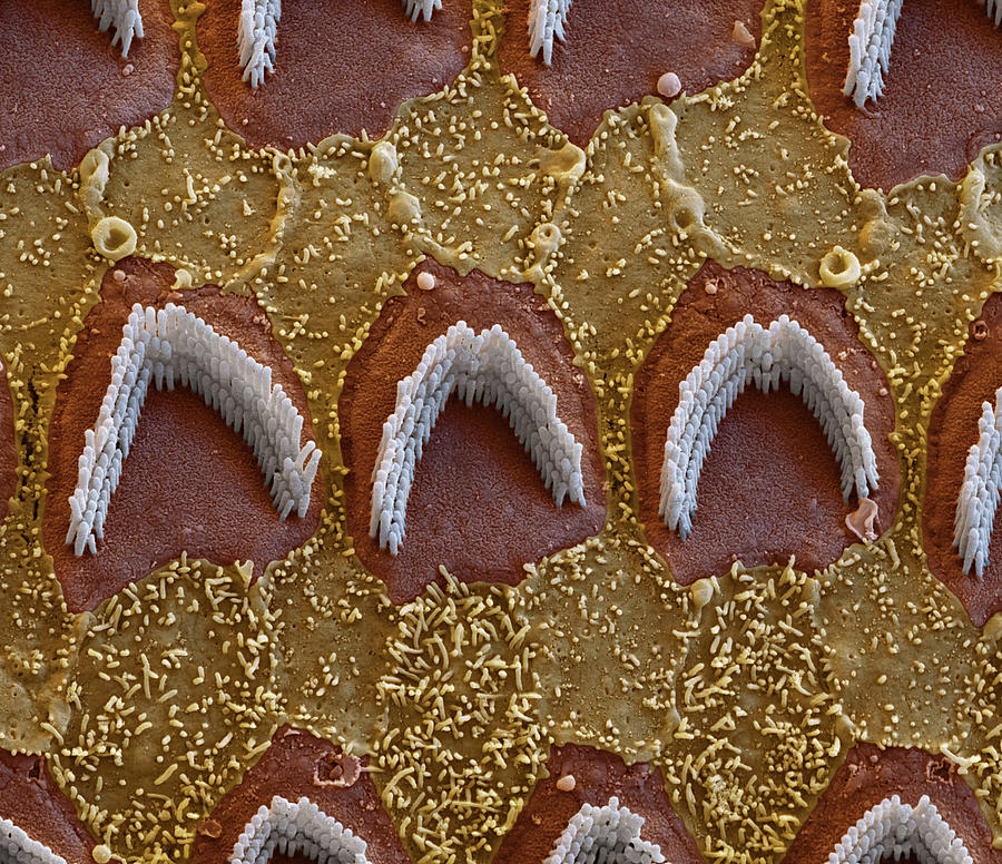 Cochlea, Outer Hair Cells, Sem #18 Photograph by Oliver Meckes EYE OF SCIENCE