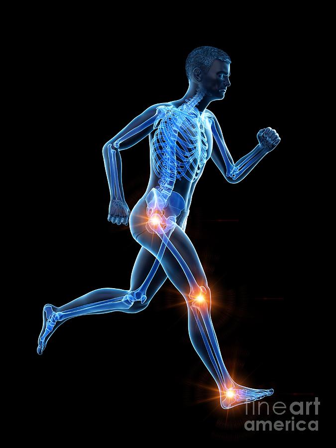 Runner With Joint Pain #18 Photograph by Sebastian Kaulitzki/science Photo Library