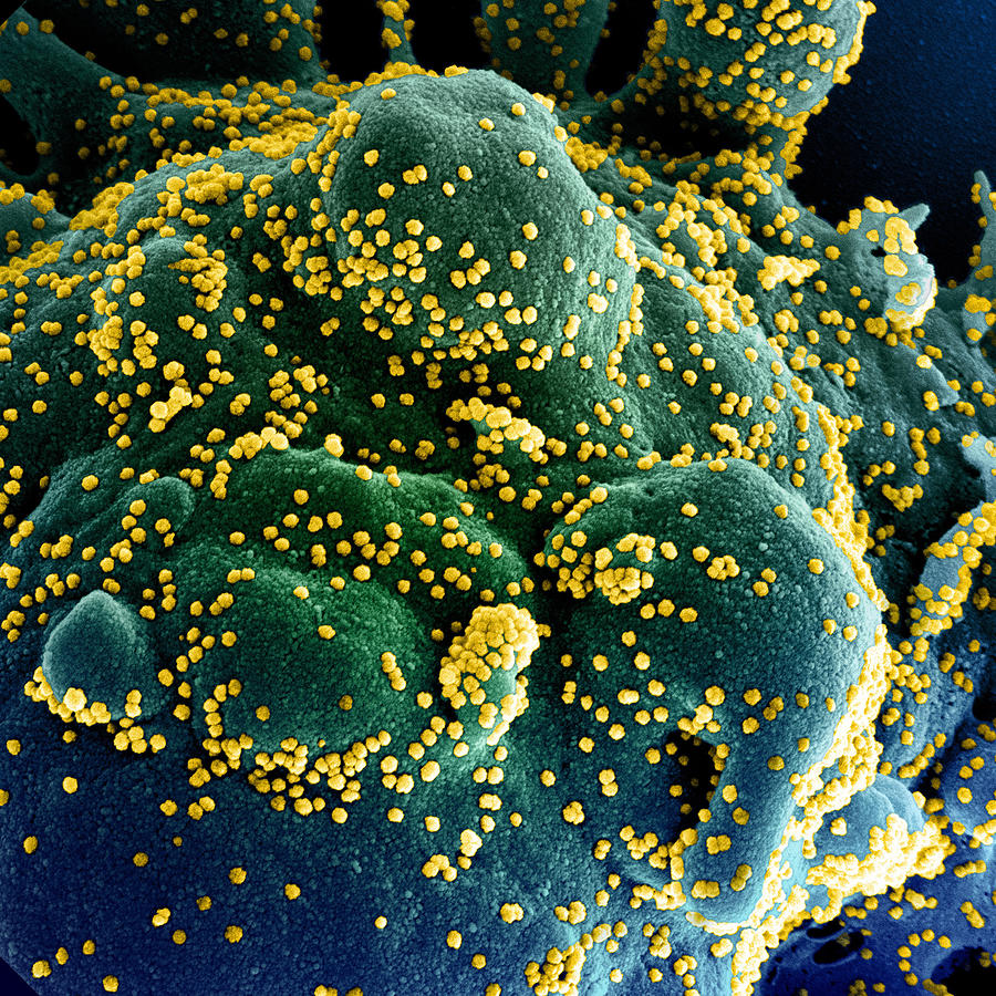 Sars-cov-2, Covid-19 Virus, Sem #18 Photograph by Science Source