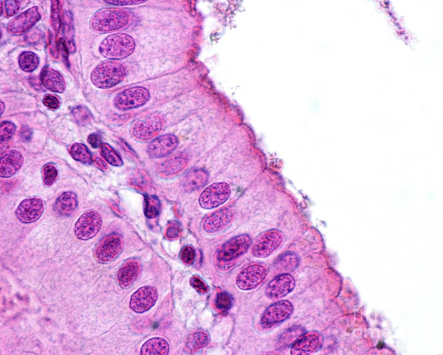 Simple Columnar Epithelium Photograph by Jose Calvo / Science Photo ...