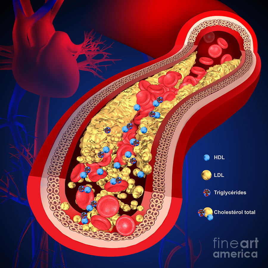 Cholesterol #19 by Fernando Da Cunha/science Photo Library